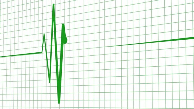 Minimal Heartbeat Line Wave Signal Animation Featuring Smooth ECG Pulse