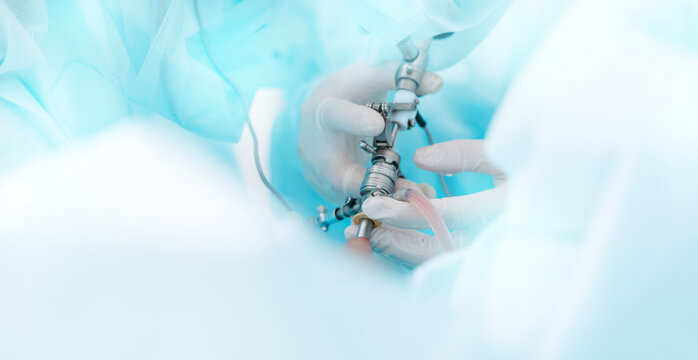 Banner Surgical team performing laparoscopic operation for prostate adenoma treatment