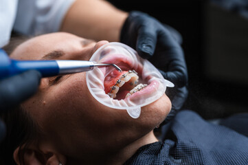Gentle Dental Hygienist Uses Ultrasonic Tools And Suction For Thorough Oral Health Maintenance
