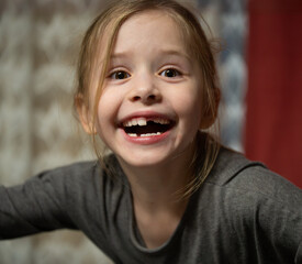 Fr&ouml;hlich lachendes Kinderportrait mit Zahnl&uuml;cke