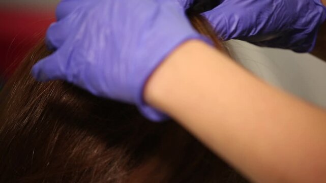 Close up view of dermatologist hands in gloves parting and examining female patient brown hair to check for dandruff, lice, dermatitis, or hair loss problems at clinic.

