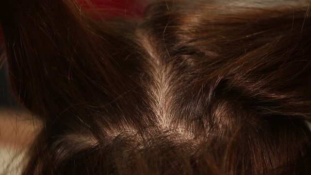 Close up view of dermatologist hands in gloves parting and examining female patient brown hair to check for dandruff, lice, dermatitis, or hair loss problems at clinic.

