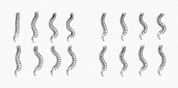 Human spine anatomy with various curvatures and conditions, vector illustration for medical and educational purposes.