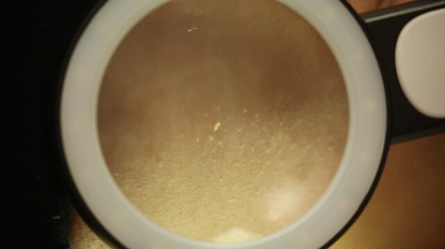 Macro view through a dermatoscope showing human skin texture, pores, and hair. A dermatologist examines the epidermis for lesions, moles, or melanoma during a professional medical screening.

