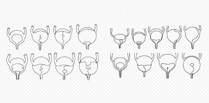 Set of human bladder line art icons showing various conditions and anatomy.