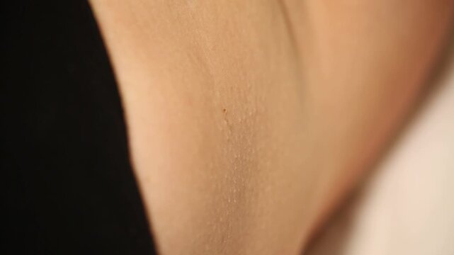 Close up of a doctor removing a small skin tag on a female armpit using an electric cautery tool in a clinic.

