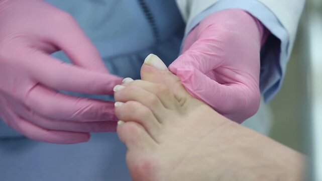 Professional podiatrist in pink gloves installing a titanium wire brace to correct an ingrown toenail shape and relieve pain during a medical pedicure procedure in a clinic.


