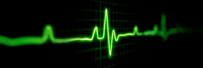 A healthy green cardiogram heartbeat on a monitor shows a steady pulse line