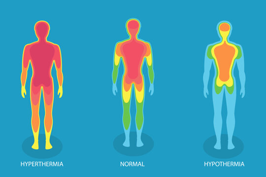 3D Isometric Flat Vector Illustration of Human Body Temperature, Hyperthermia And Hypothermia