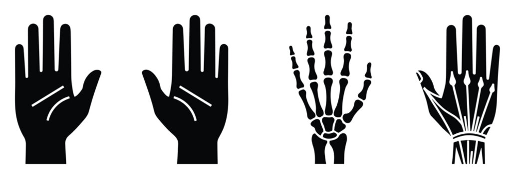 Anatomy of hand and skeletal system in medical diagram depicting metacarpals and phalanges bone structure