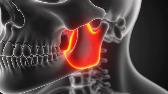 Detailed medical visualization of human skull profile with glowing red highlight on temporomandibular joint indicating pain.