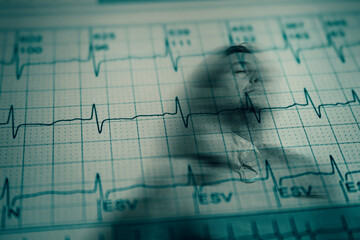 Worried adult male face over damaged electrocardiogram showing cardiac distress