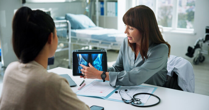 Doctor, woman and tablet for xray with consultation, bone fracture and results or diagnosis. Healthcare, patient and professional with MRI screen in clinic for knee dislocation and treatment plan