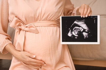 Young pregnant woman with sonogram image at home, closeup