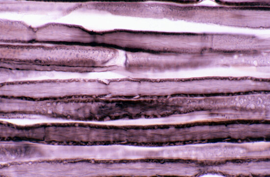 Nerve fibre. Schmidt-Lanterman clefts
