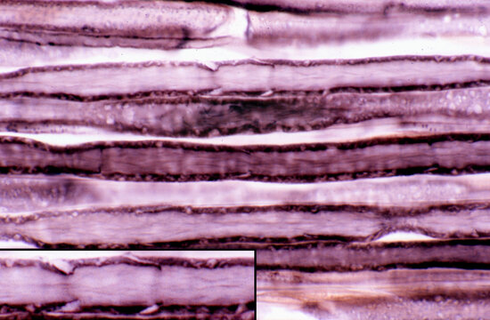 Nerve fibre. Schmidt-Lanterman clefts