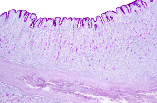 Gastric mucosa