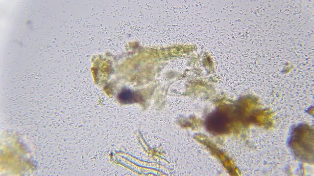 Dead bacteria in essential oil under 400x brightfield microscopy showing antimicrobial effect