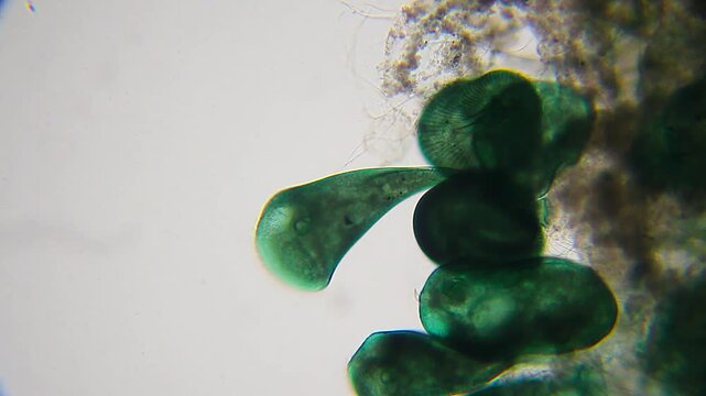 Colony of stentor ciliates with visible oral funnel, surrounding cilia, macronucleus, micronucleus and contractile vacuole under 100x brightfield microscopy. Detailed 4k microscopic view