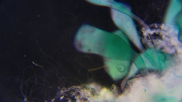 Colony of stentor ciliates with visible oral funnel, surrounding cilia, macronucleus, micronucleus and contractile vacuole under 100x darkfield microscopy. Detailed 4k microscopic view