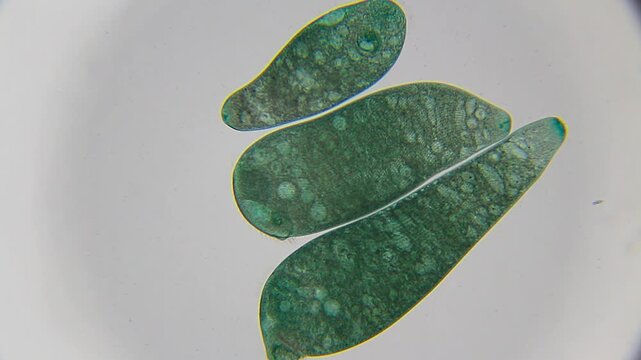 Three stentor ciliates with visible oral funnel, surrounding cilia, macronucleus, micronucleus and contractile vacuole under 100x brightfield microscopy. Detailed 4k microscopic view