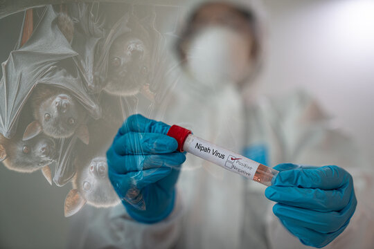 Nipah virus (NiV) structure, a zoonotic paramyxovirus transmitted by fruit bats. Medical concept for encephalitis outbreak, pandemic alert, and virology research visuals.