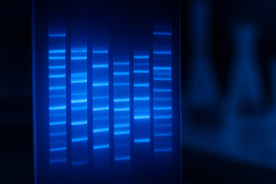 Blue digital electrophoresis gel screen displaying glowing DNA band patterns for genomic sequencing and genetic profiling analysis
