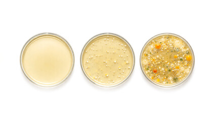 Three Petri dishes displaying different stages of bacterial growth. Clean microbiology laboratory background ideal for scientific research, medical education, biotechnology and clinical study concepts