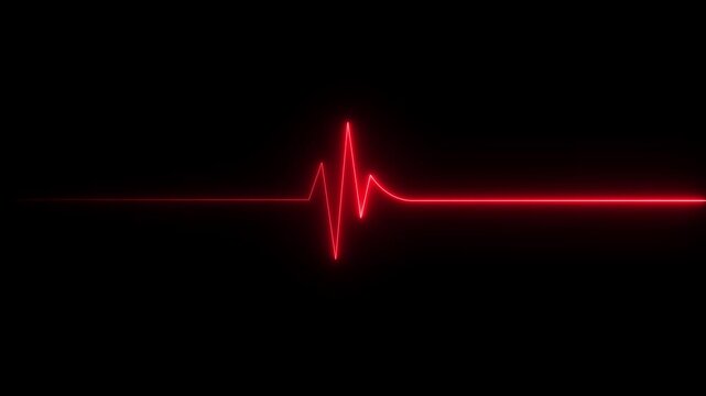 electrocardiogram (EKG or ECG) loop beeping at 60 beats per minute for screen savers or computer monitor displays, medical heartbeat monitor HUD animation loop