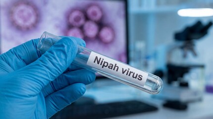Nipah virus research laboratory medical science clinical environment close-up view infectious disease awareness