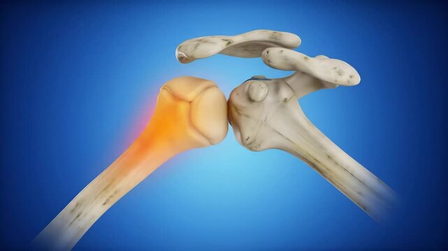 Anatomical Illustration of Human Shoulder Joint with Inflammation
