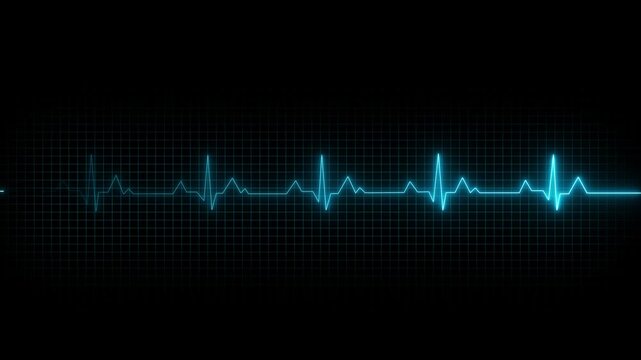 Bright heart rhythm background 4K heartbeat monitor EKG line monitor shows heartbeat ,EKG machine at veterinary clinic during surgery, heartbeat on screen, Motion graphics of heartbeat concept