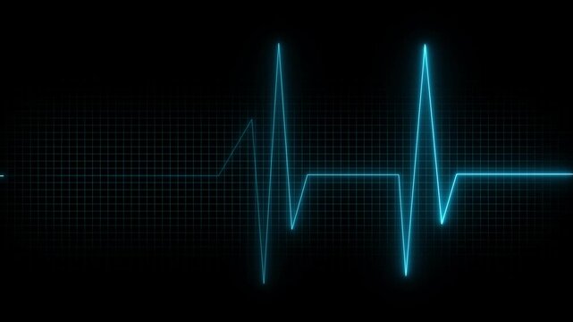Monitoring of patient's condition, vital signs on ICU monitor in hospital Heart and patient monitor showing vital signs of a patient. Motion graphics of pulse neon line concept