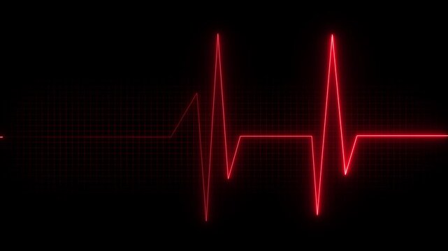 Monitoring of patient's condition, vital signs on ICU monitor in hospital Heart and patient monitor showing vital signs of a patient. Motion graphics of pulse neon line concept