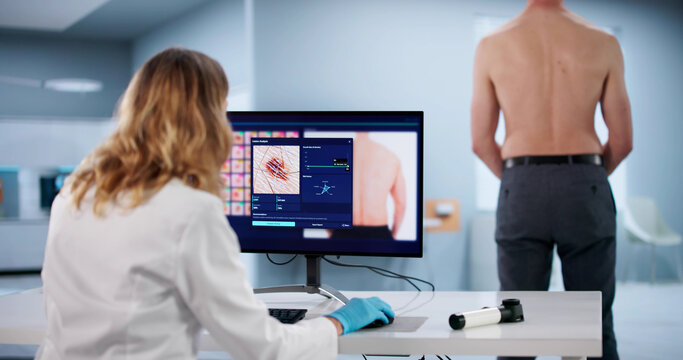 Digital Dermatoscopy: Clinician Screens Patient's Skin