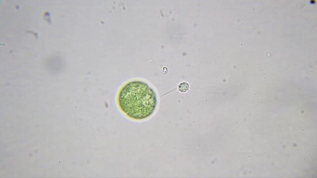 Round green cyanobacterium in division stage with a nearby heliozoan-like protozoan under 2000x brightfield microscopy using immersion oil. Detailed 4k microscopic view.