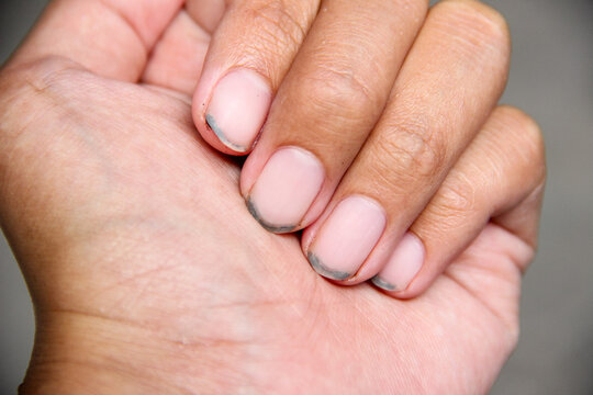Close up of dirt that accumulates under fingernails. Hand care. Personal hygiene