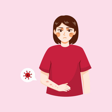 An illustration showing a woman experiencing skin allergy symptoms such as redness and irritation, suitable for medical education and dermatology awareness content.