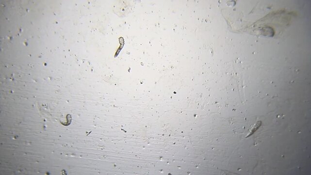 Three Demodex folliculorum mites visible together under 40x brightfield microscopy. Detailed 4k microscopic view of skin parasites and their body structure.