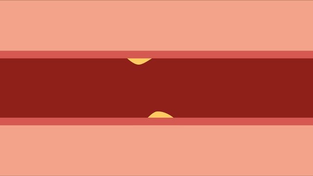 Blocked blood vessel animation showing artery clog and circulation risk
