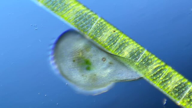 Single-celled ciliate Stentor under the microscope at 100x Magnification