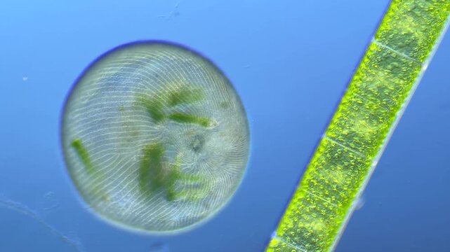 Single-celled ciliate Stentor under the microscope at 100x Magnification