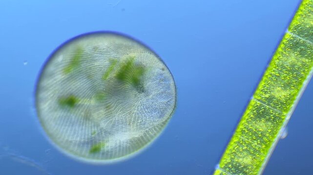 Single-celled ciliate Stentor under the microscope at 100x Magnification