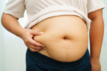 Asian woman use hand to squeeze fat belly big size overweight and obesity.