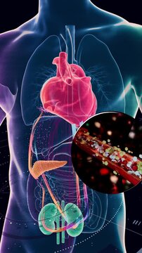 Cardiometabolic CKM Syndrome 3D Visualization: Integrated Heart, Kidney, and Pancreatic Health with 4D Flow MRI Data Overlays