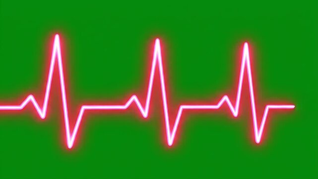 Heartbeat Pulse on Green Screen - A glowing pink electrocardiogram (EKG) heartbeat line scrolls across a green screen background. This could be used to indicate heart health or medical diagnostics.