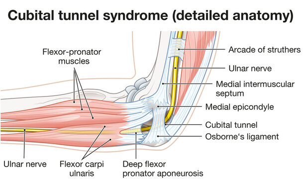 Cubital tunnel syndrome anatomy showing ulnar nerve entrapment structures