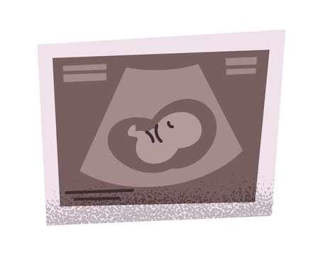 Baby fetus ultrasound scan image