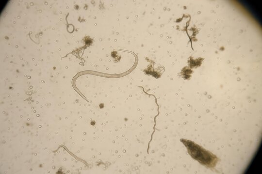 Microscopic nematode parasite worm in laboratory sample under light microscope
