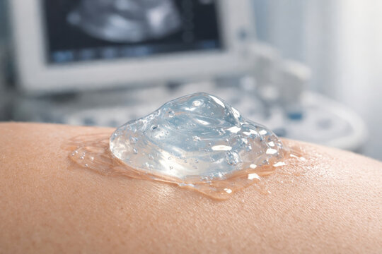 Ultrasound gel abdomen fatty liver health nafld medical diagnosis hospital ultrasound gel abdomen supports fatty liver health check and nafld screening during medical diagnosis hospital setting